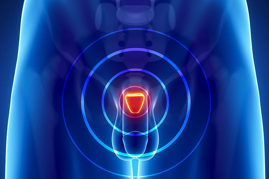 Prostate and GU Cancer Illustration