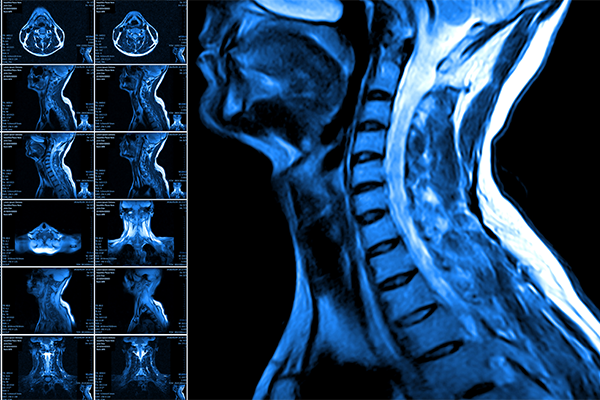 medical images of head and neck