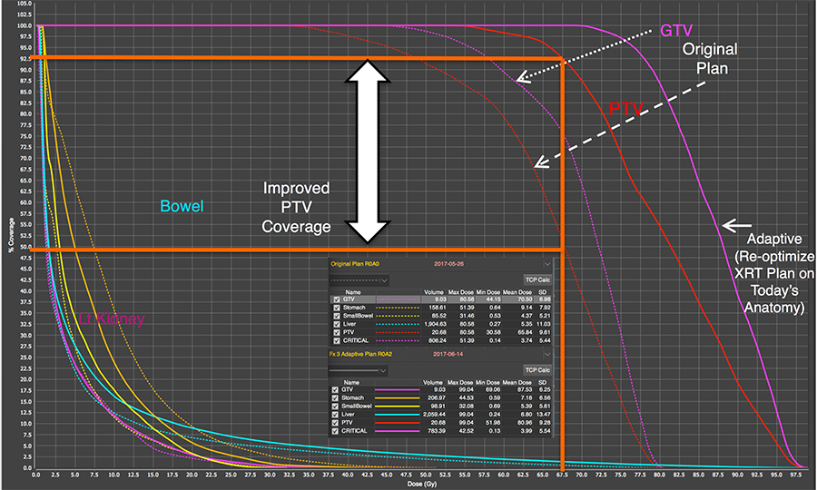 Dose Volume Histogram for two treatment plans, the original plan and an adaptive plan.