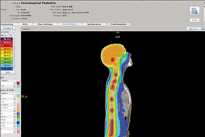 Tomotherapy treatment planning