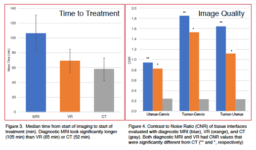 Two graphs comparing 0.35T MRI on ViewRay system for brachytherapy and to compare dosimetry, time to treatment and image quality relative to diagnostic MRI and CT.