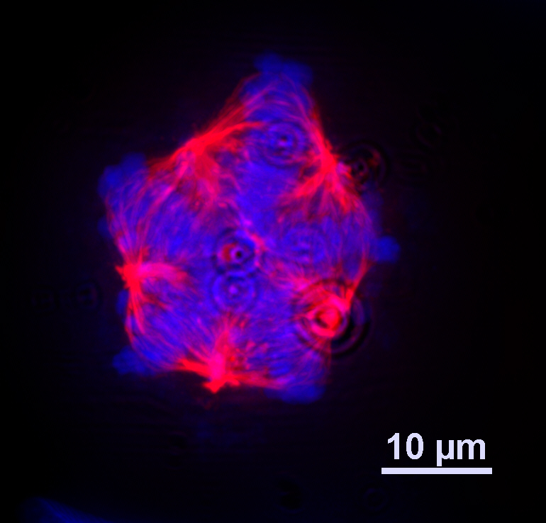HPV-postive cell in mitosis with 5 spindle poles. Red- tubulin, Blue - DAPI