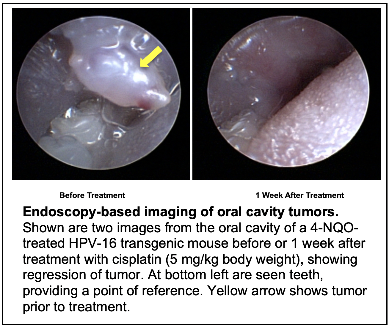 Endoscopy images