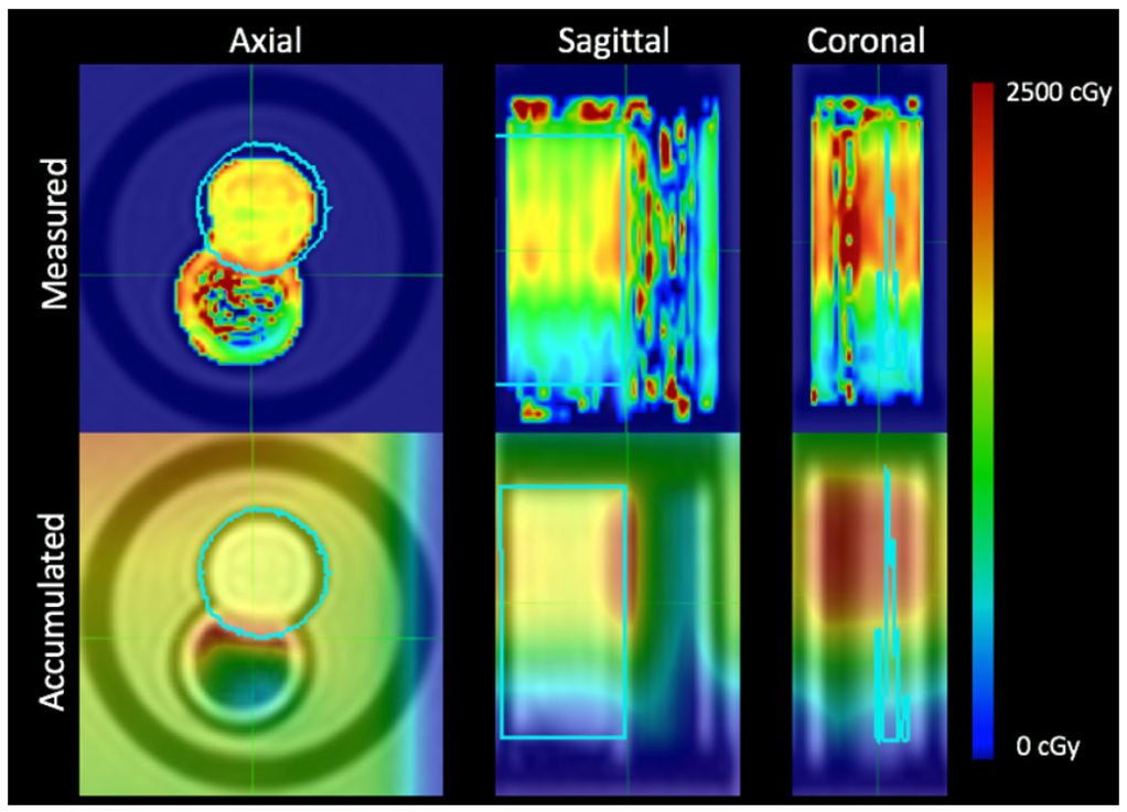 Measured 3D dose distributions